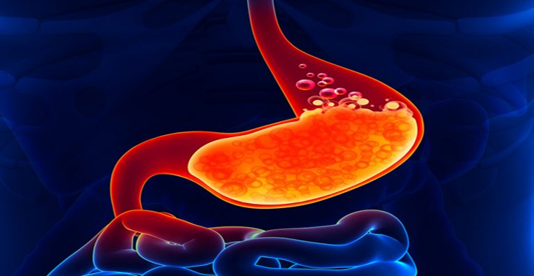 Proton pump inhibitors: a clinical overview - Hospital Pharmacy ...