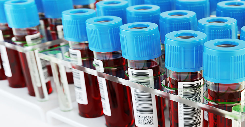 Blood samples to help select the right early phase clinical trials for cancer patients