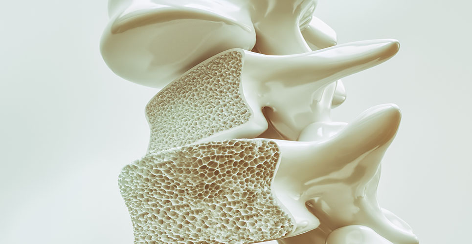 Studies highlight potential new option in treating bone loss