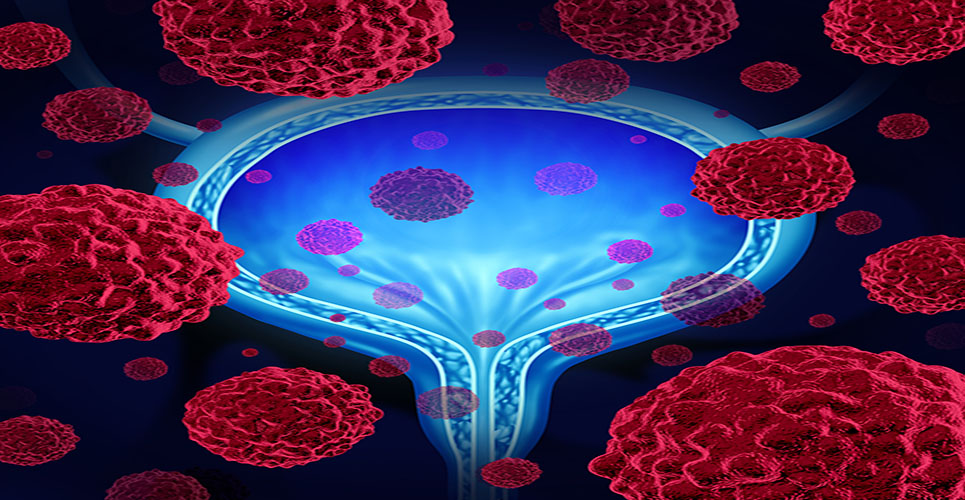 NICE approves new advanced bladder cancer immunotherapy