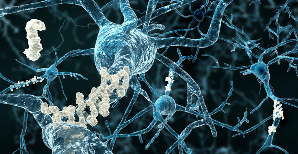 FDA approves aducanumab, a first-in-class drug, for Alzheimer’s disease