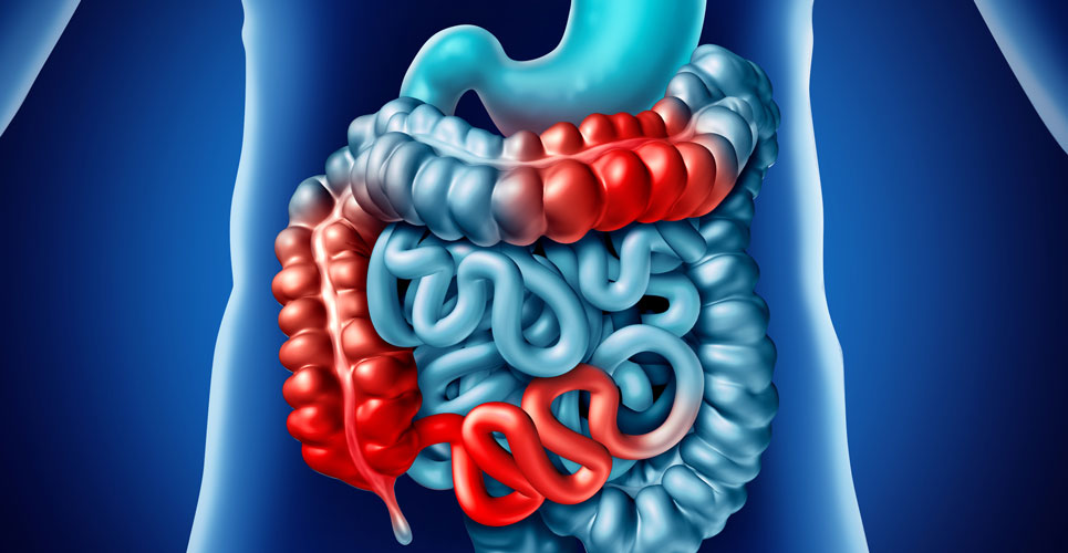 New gastrointestinal symptoms in IBD linked with COVID-19