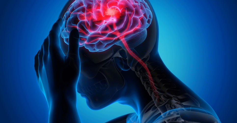 Endovascular treatment outcomes not improved with alteplase in stroke patients