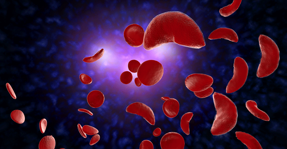 Sickle cell disease patients’ heightened awareness of COVID-19 risks reduced cases