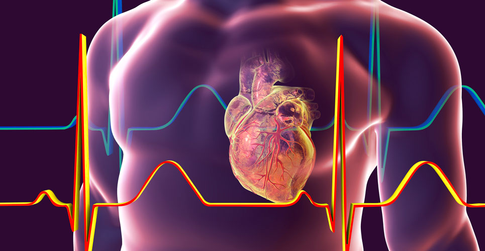 Prior heart disease improves survival after out-of-hospital cardiac arrest