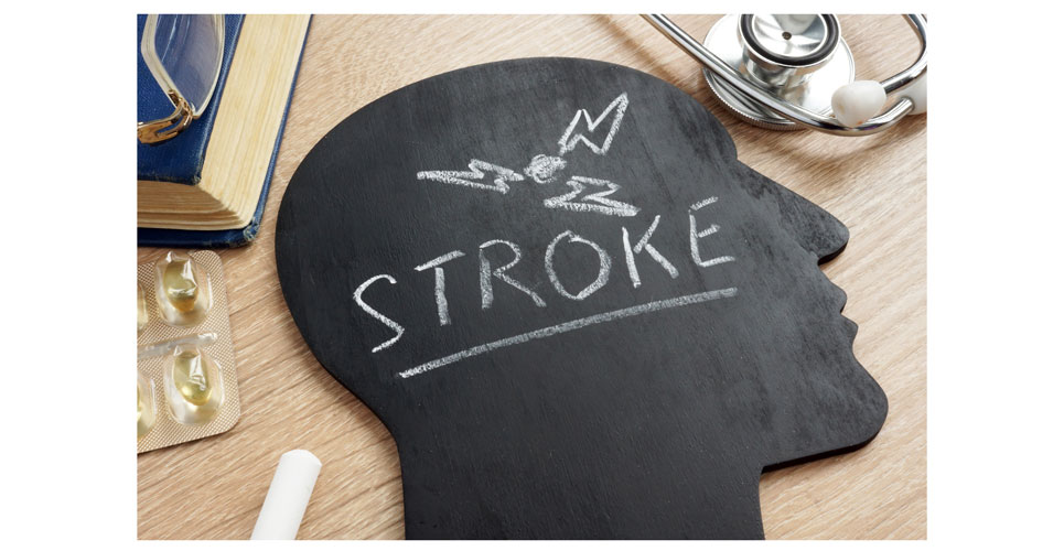 stroke risk