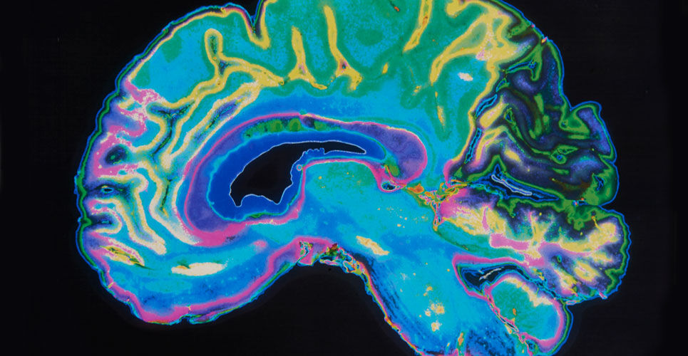 MRI-based deep learning allows identification of prodromal Alzheimer's disease