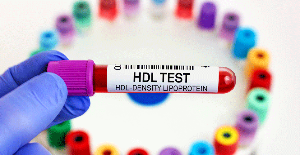 HDL cholesterol cardioprotective role questioned