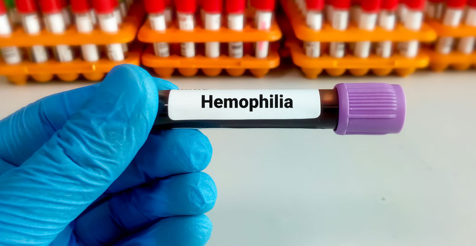 Efanesoctocog alfa effective for haemophilia A
