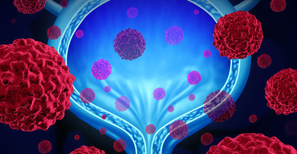 Trial finds pembrolizumab benefits high-risk BCG non-responsive bladder cancer patients