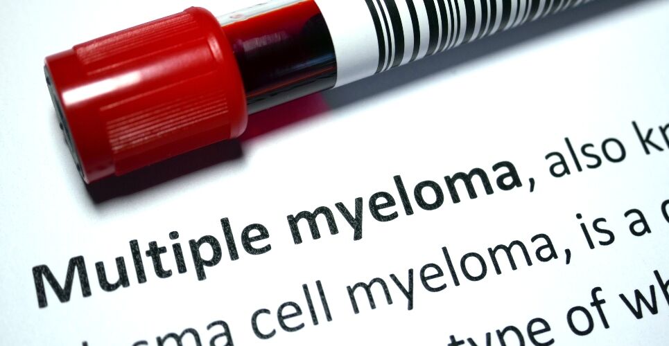 Lenalidomide-refractory multiple myeloma survival improved with selinexor triple therapy