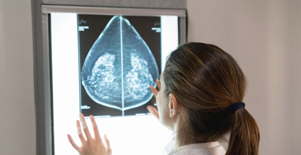 Breast cancer prevention now included in anastrozole indication after MHRA approval