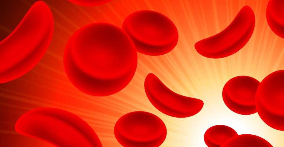 Exa-cel approved as world-first gene therapy with curative potential in sickle cell disease
