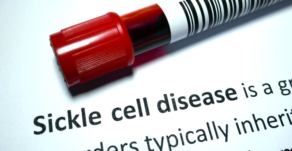 Curative exa-cel gene therapy approved in Europe for severe sickle cell disease